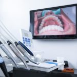 What You Need To Know About LASER GUM TREATMENT