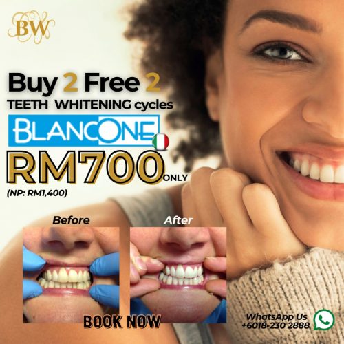 teeth whitening teeth whitening