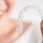 Why Angel Aligner Is The Best Invisalign’s Alternative?
