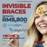 INVISIBLE BRACES – CLEAR ALIGNER PACKAGE