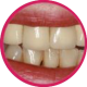 discolored teeth